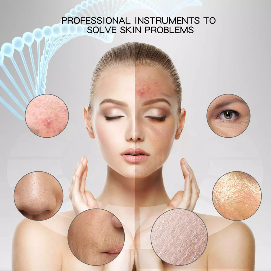 Peeling Ultrasonico Limpieza Facial