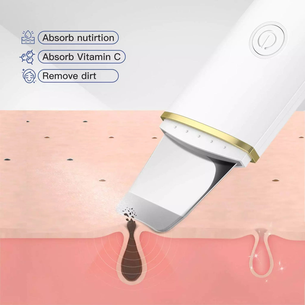 Peeling Ultrasonico Limpieza Facial